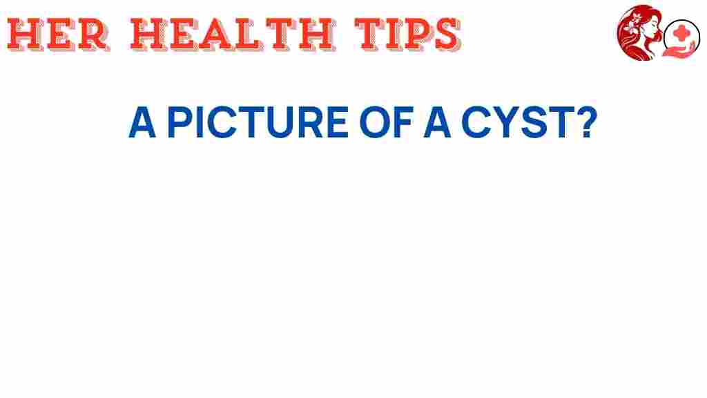cyst-appearance-health