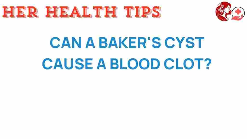bakers-cyst-blood-clot