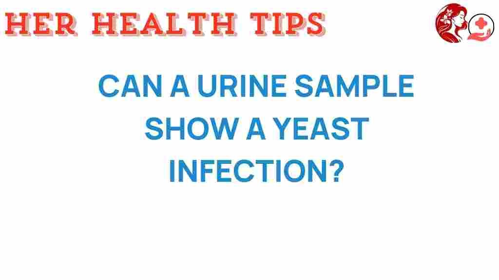 can-a-urine-sample-show-a-yeast-infection