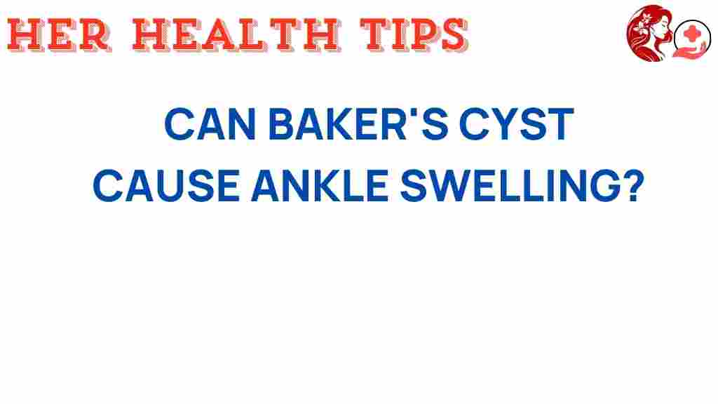 bakers-cyst-ankle-swelling