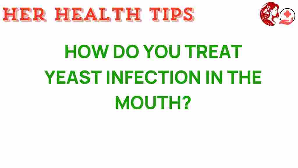 yeast-infection-treatment-mouth