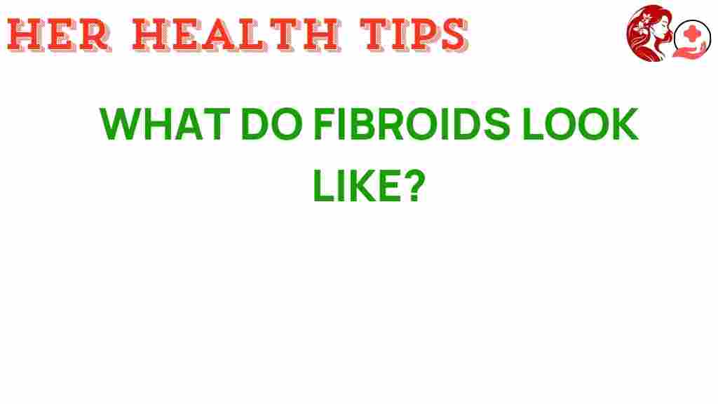 fibroids-what-to-look-for