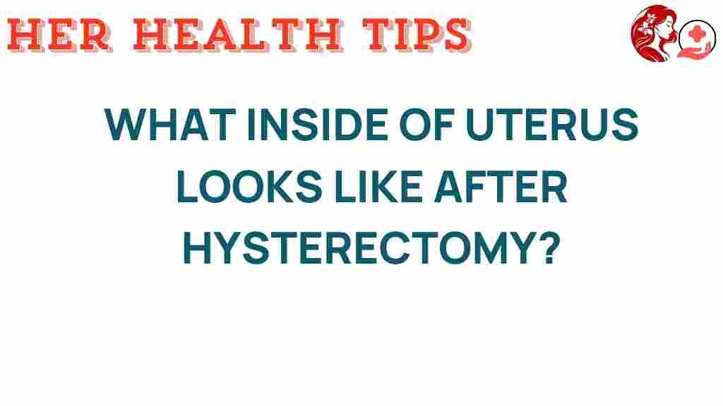 hysterectomy-uterus-post-surgery
